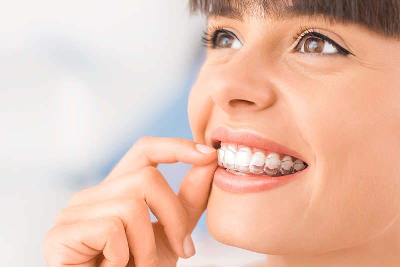 Adult holding invisalign teeth straightener 