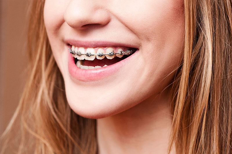 Orthodontics in San Juan Capistrano